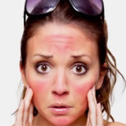 تصویر برای دسته  افترسان (مراقبت بعد از آفتاب)